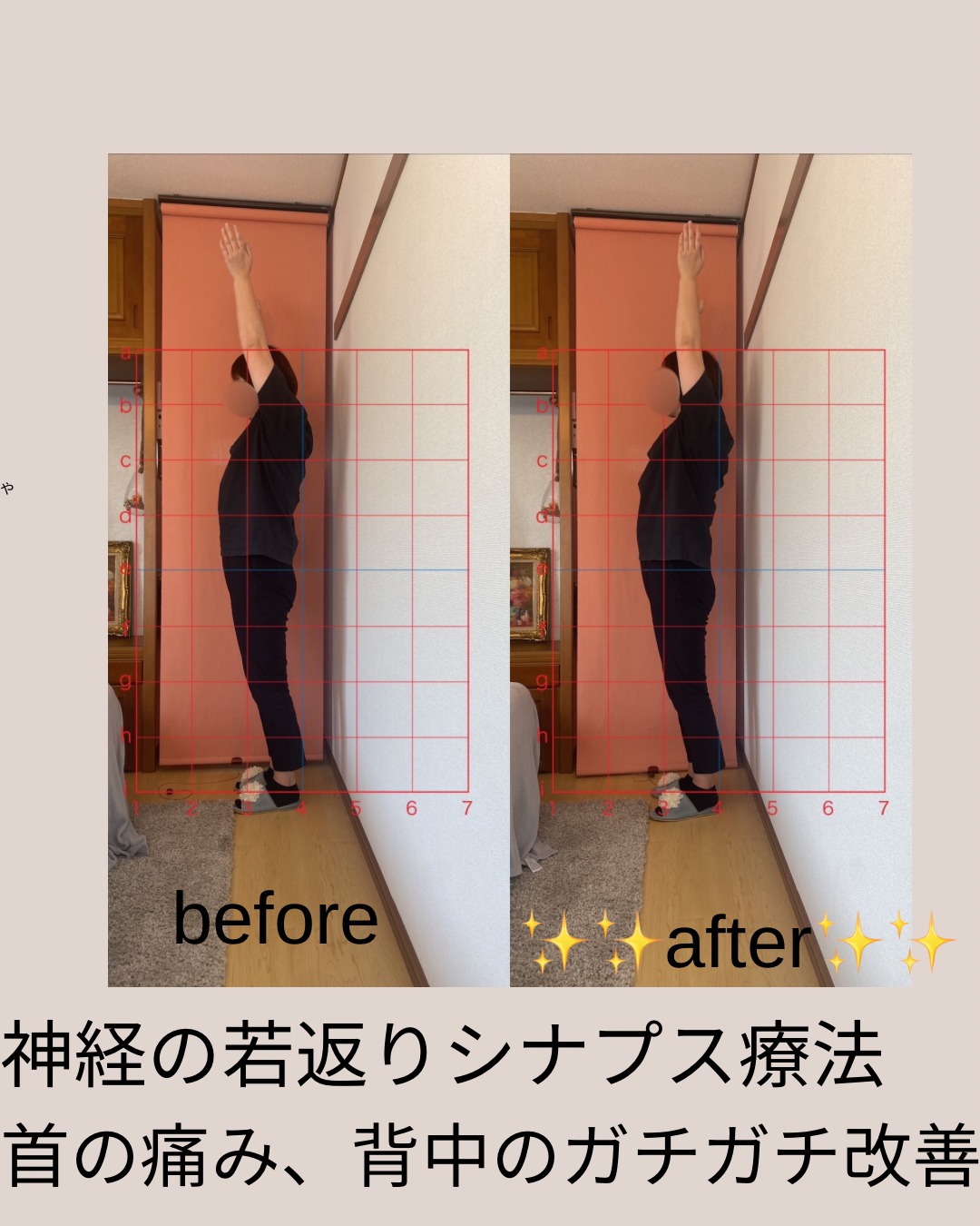 ✨シナプス療法✨
